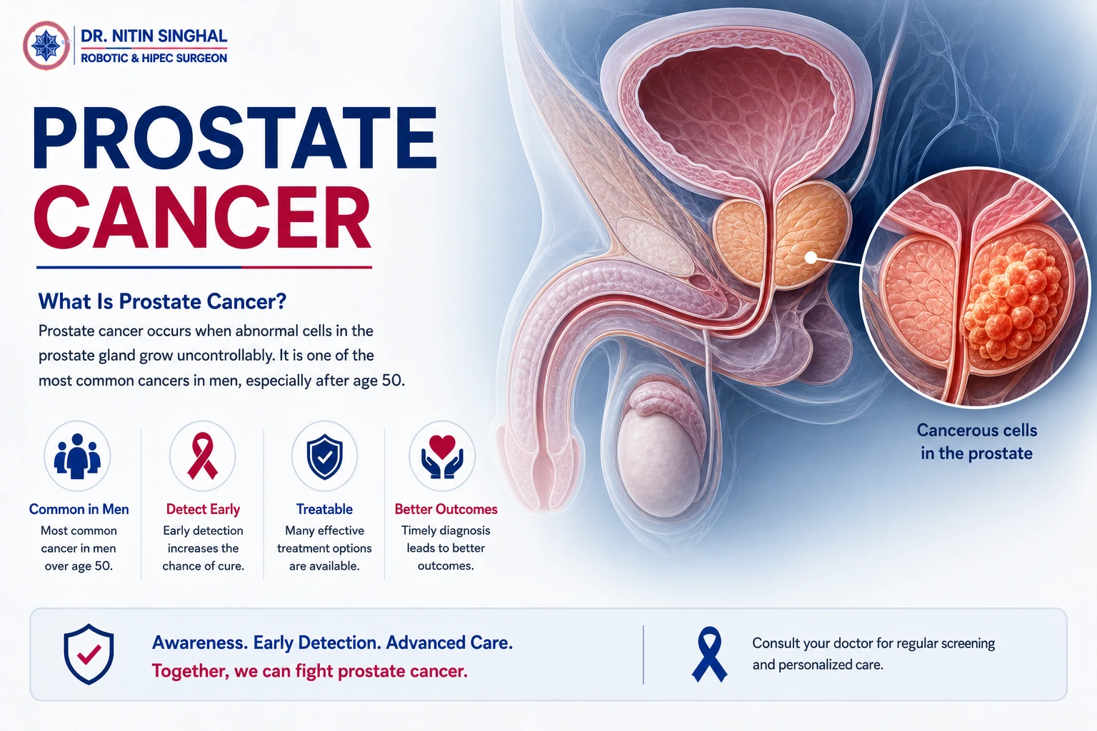 Prostate anatomy — robotic prostate cancer surgery, Dr. Nitin Singhal, Ahmedabad