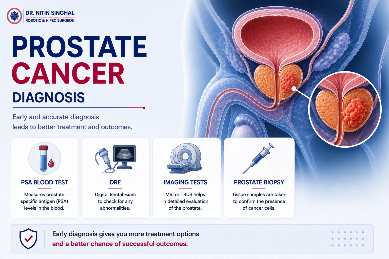 Prostate cancer diagnosis illustration