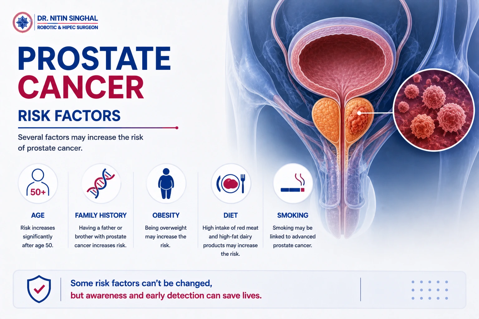 Prostate cancer risk factors illustration