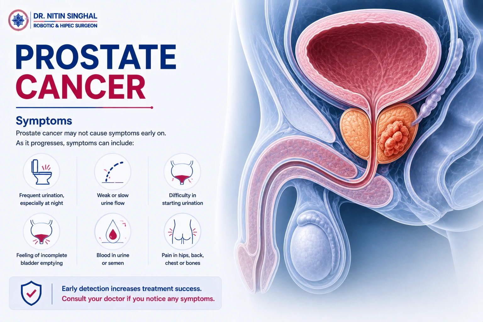 Prostate cancer symptoms illustration