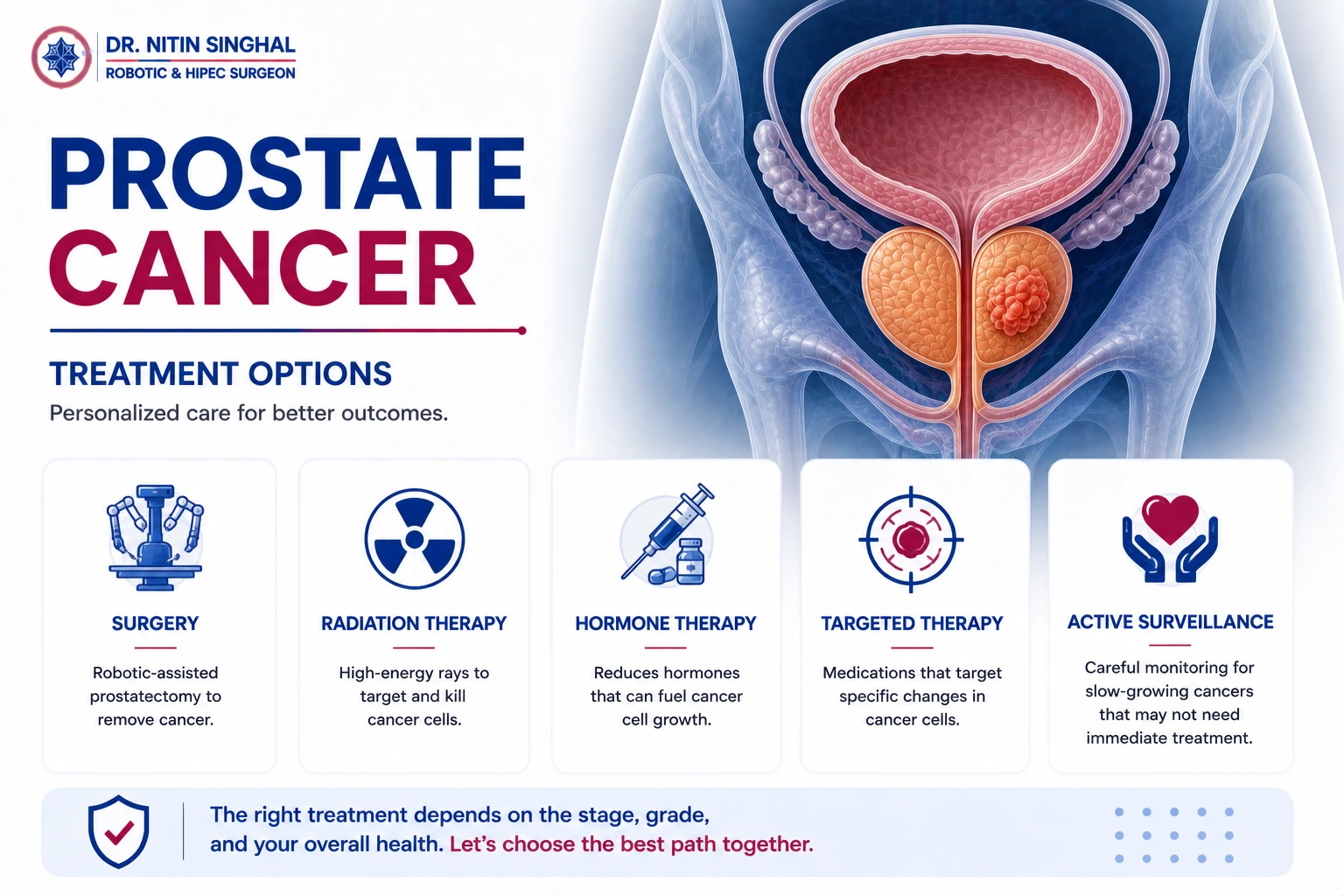 Prostate cancer treatment options illustration
