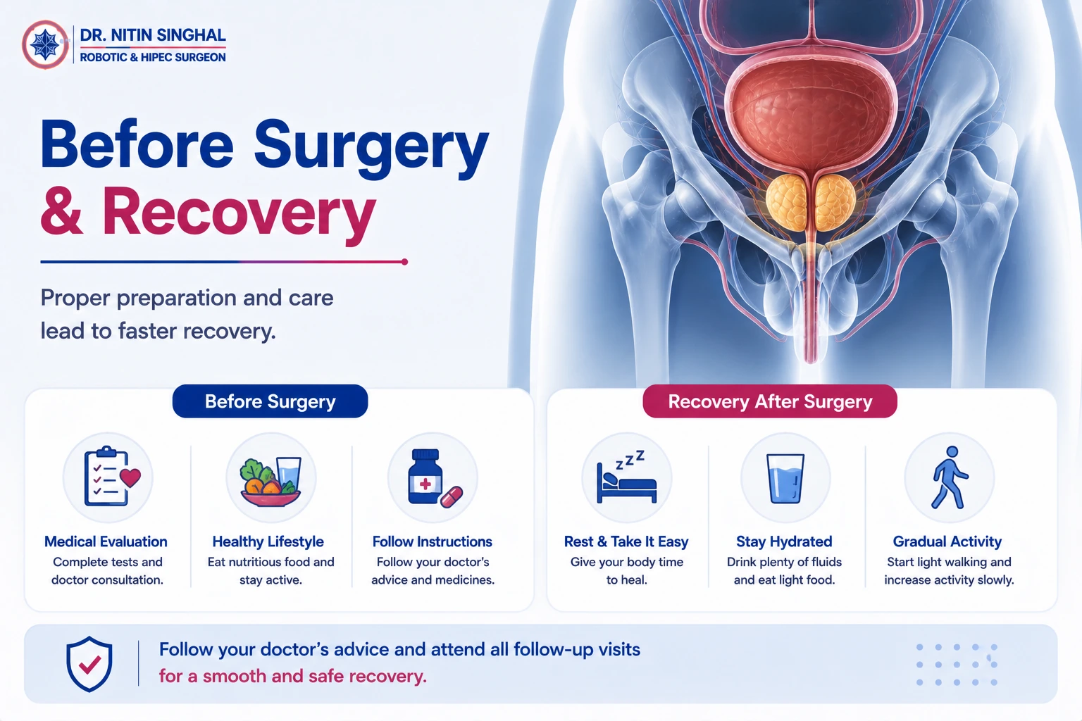 Prostate surgery recovery illustration