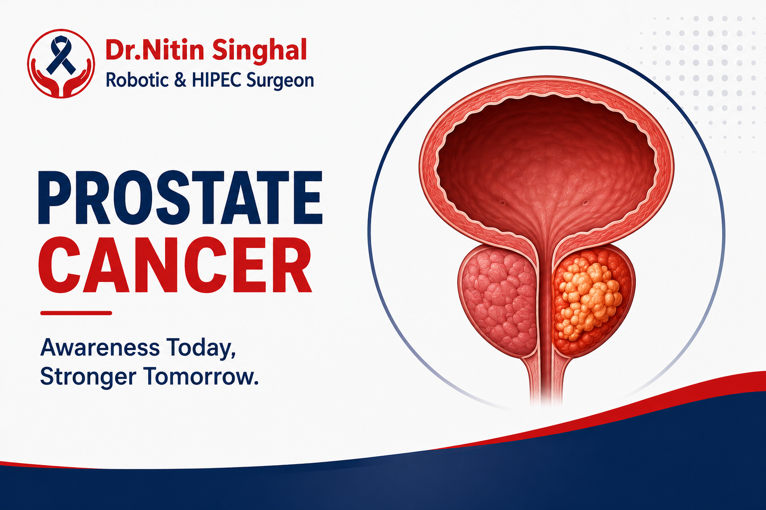 Prostate Cancer treatment icon