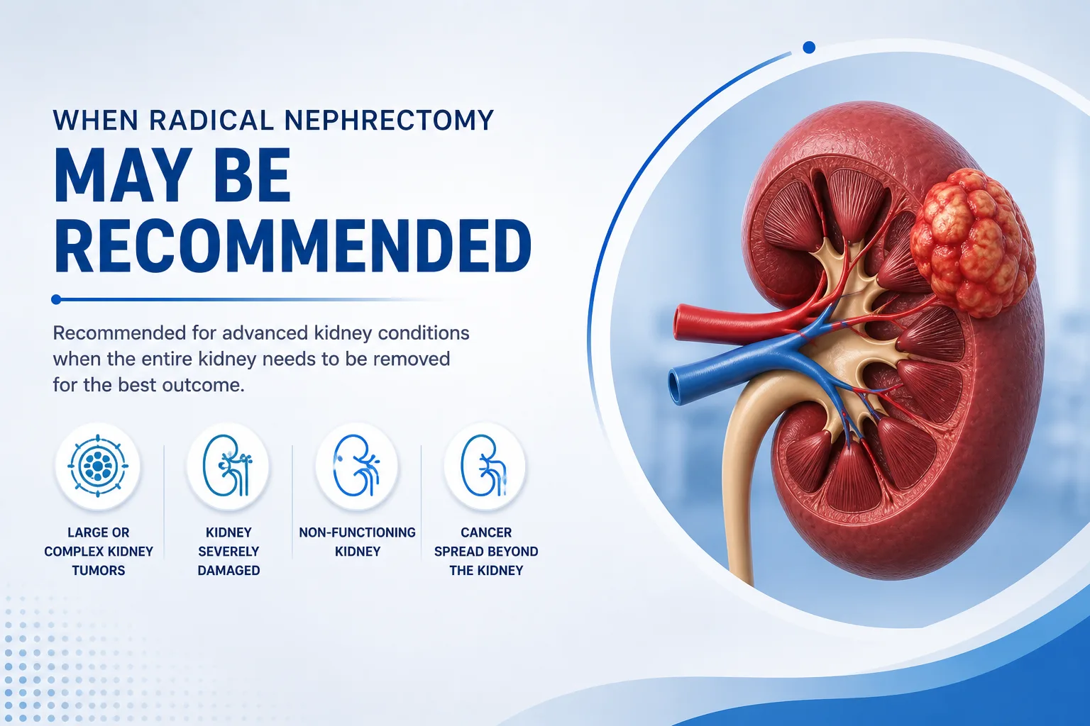When radical nephrectomy is needed illustration