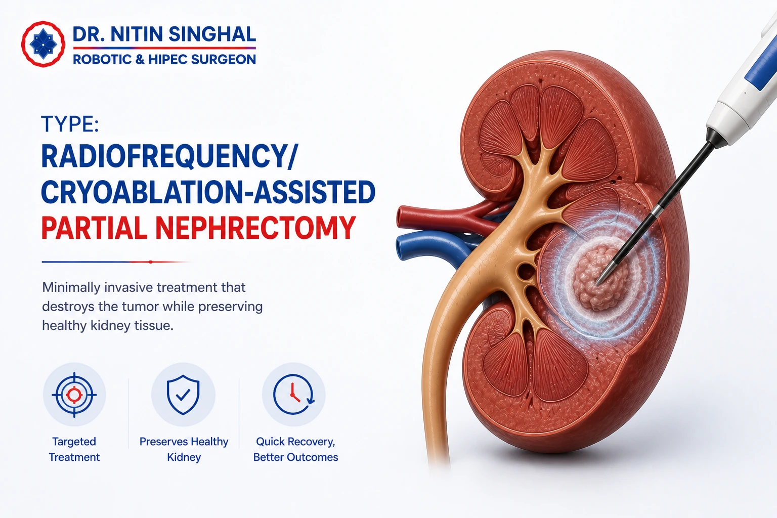 Radiofrequency ablation and cryoablation assisted treatment