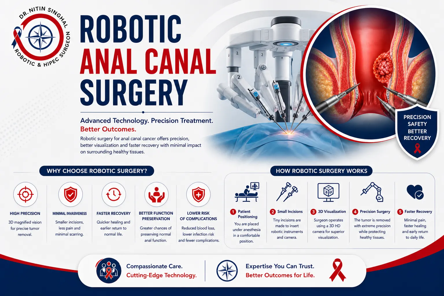 Salvage surgery for anal canal cancer illustration, Dr. Nitin Singhal Ahmedabad