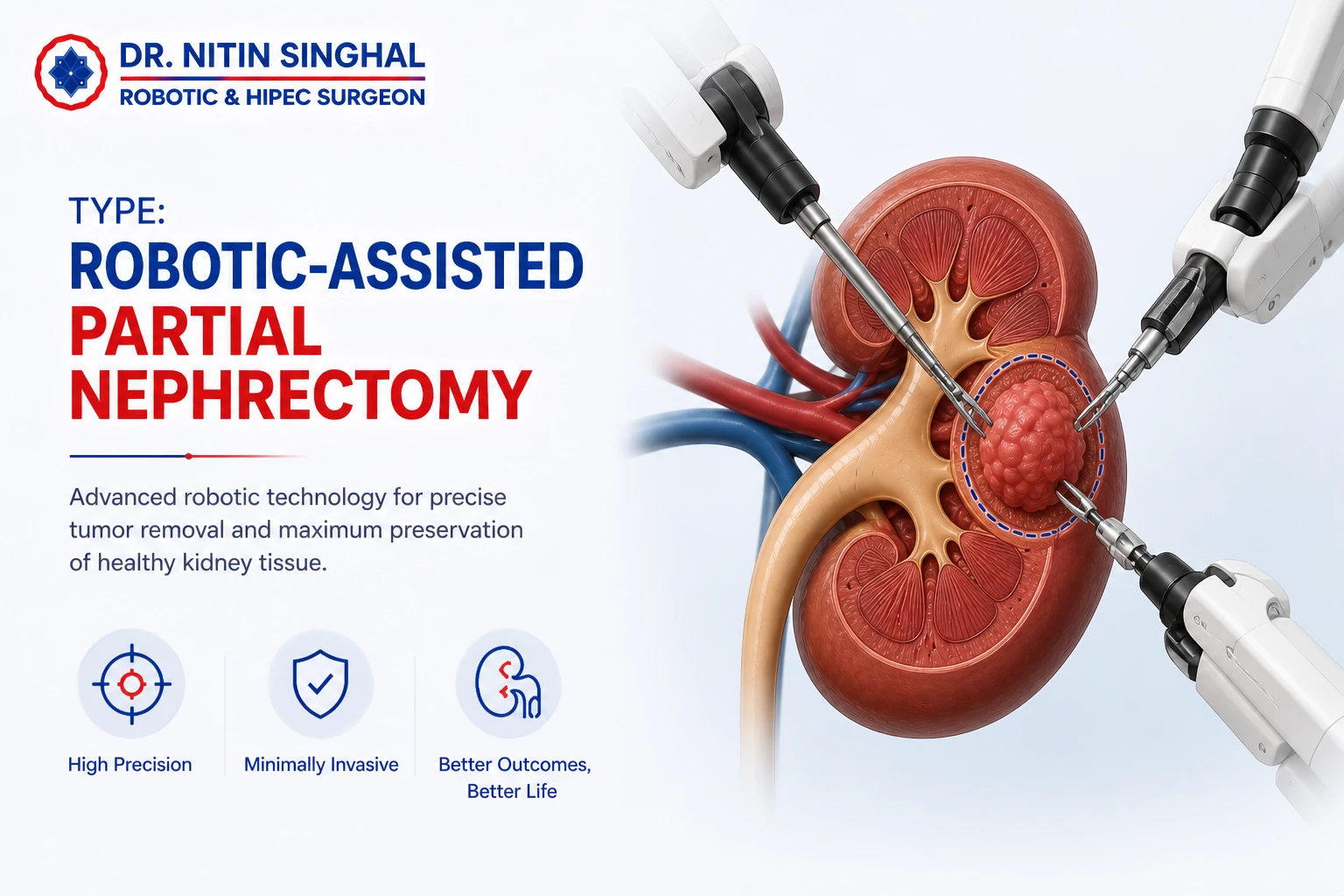 Robotic-assisted partial nephrectomy
