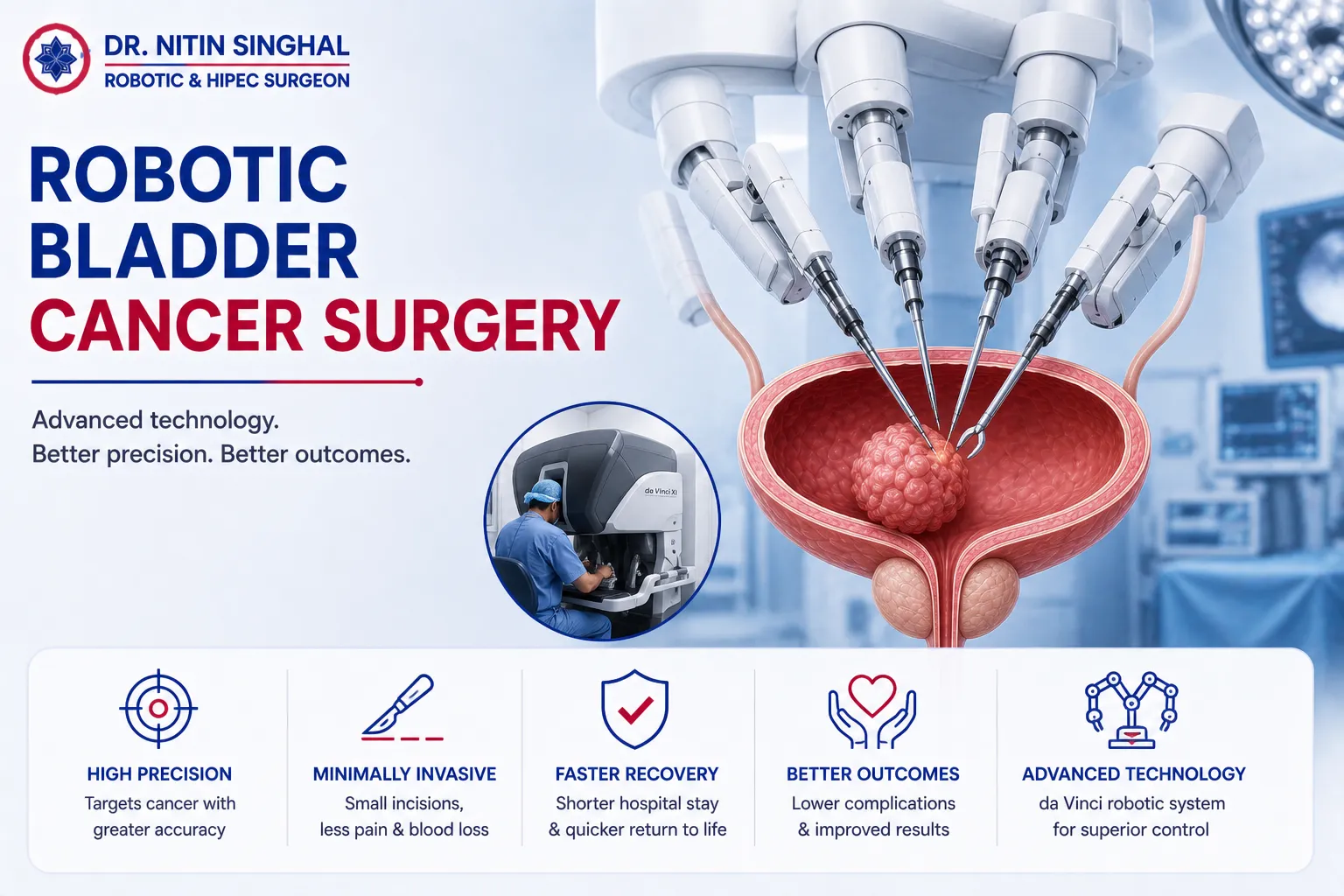 Robotic urinary bladder cancer surgery illustration, Dr. Nitin Singhal Ahmedabad