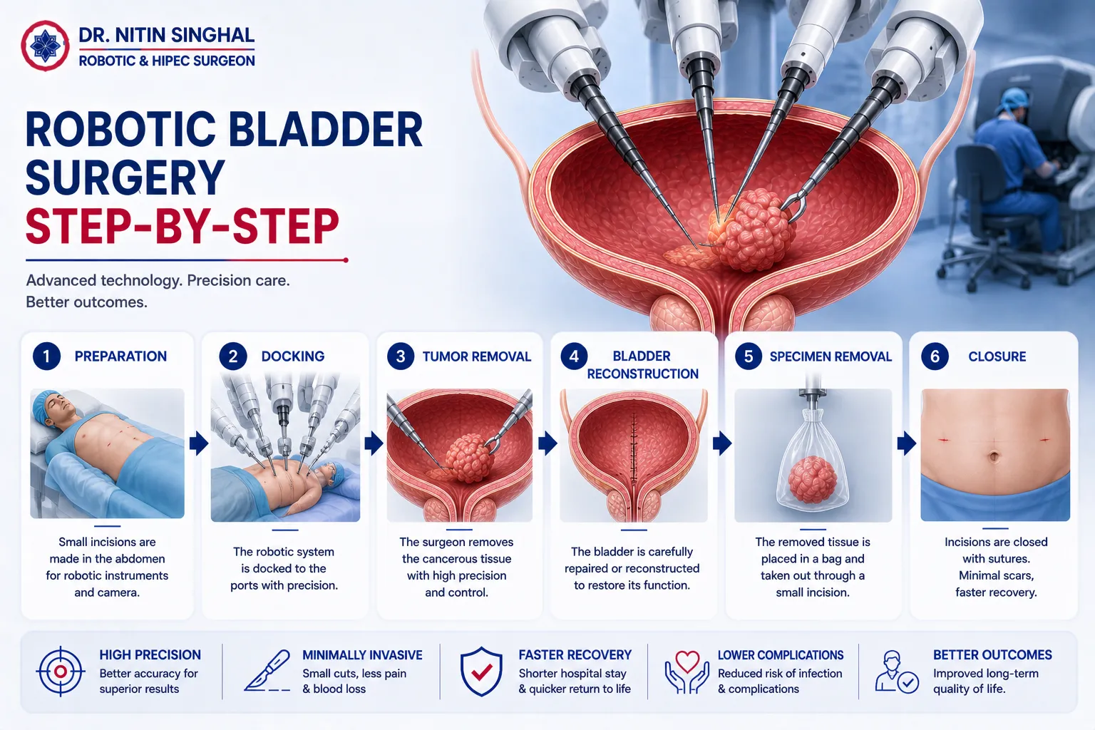Robotic bladder surgery step by step illustration