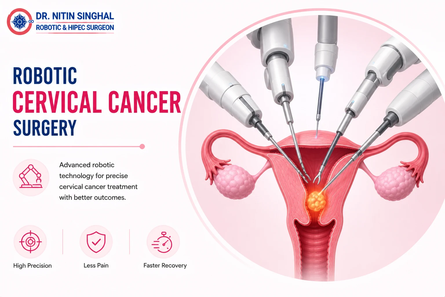 Robotic cervical cancer surgery illustration, Dr. Nitin Singhal Ahmedabad