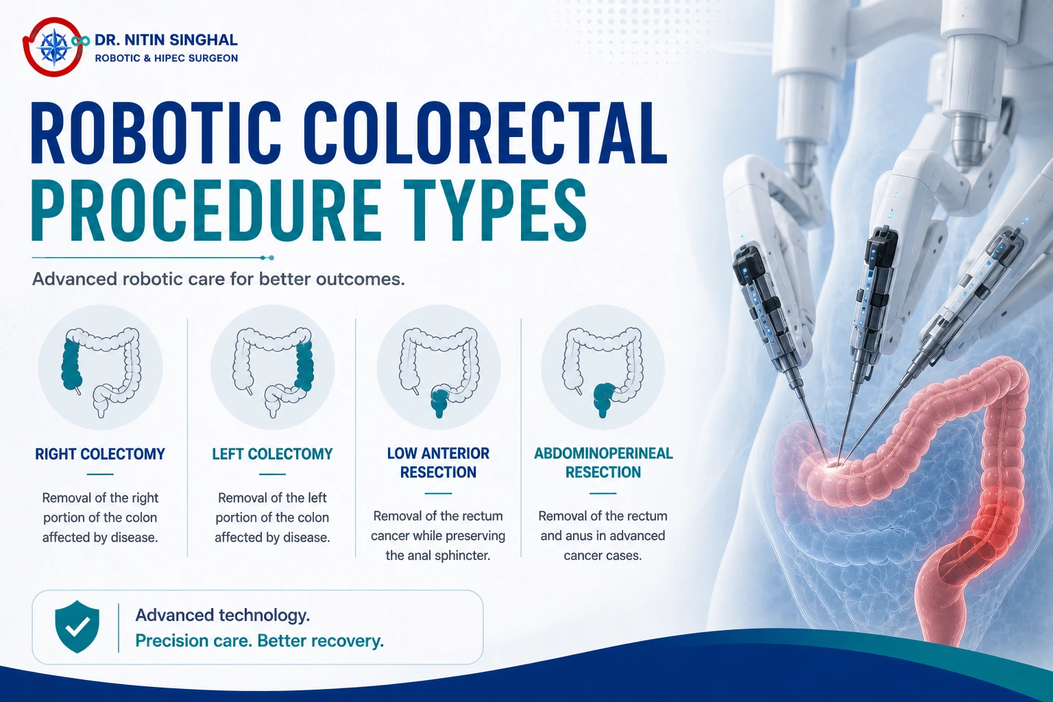 Types of robotic colorectal procedures illustration