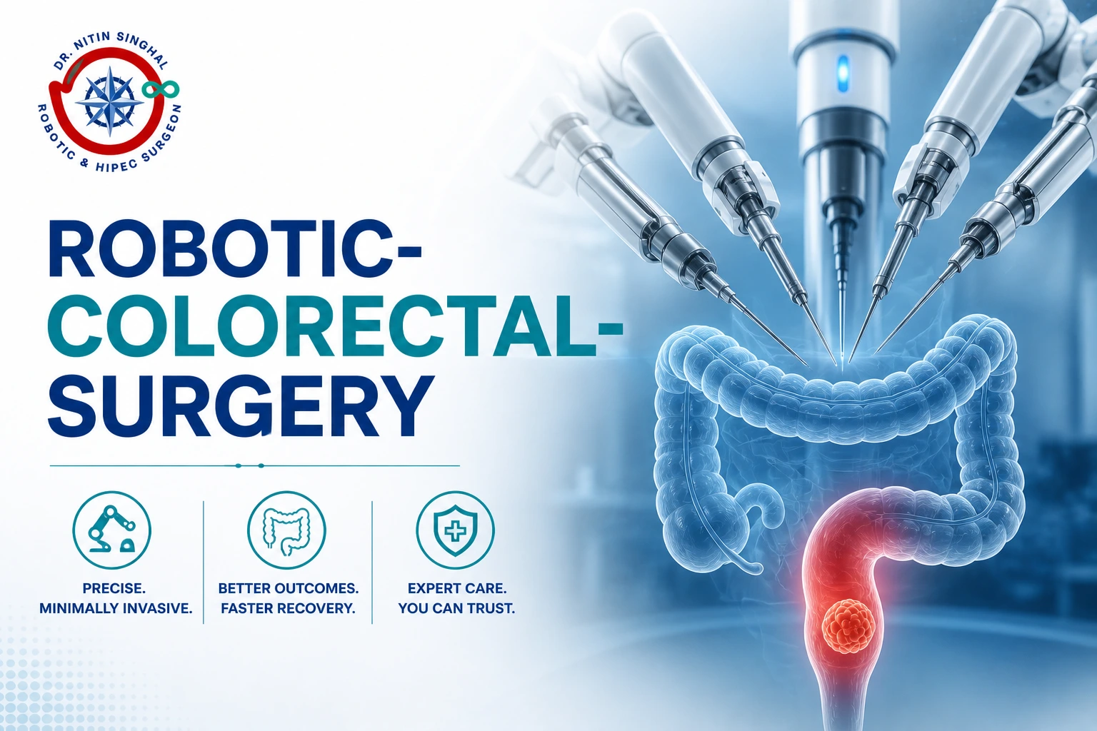 Robotic colorectal cancer surgery illustration, Dr. Nitin Singhal Ahmedabad