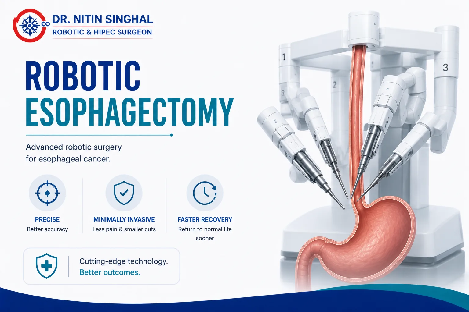 Robotic esophageal cancer surgery illustration, Dr. Nitin Singhal Ahmedabad