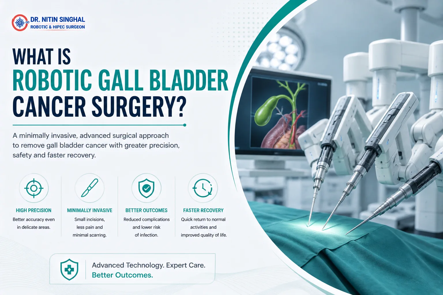 Robotic gall bladder cancer surgery illustration, Dr. Nitin Singhal Ahmedabad