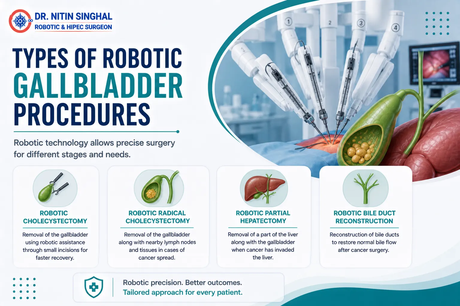Types of robotic gallbladder procedures illustration
