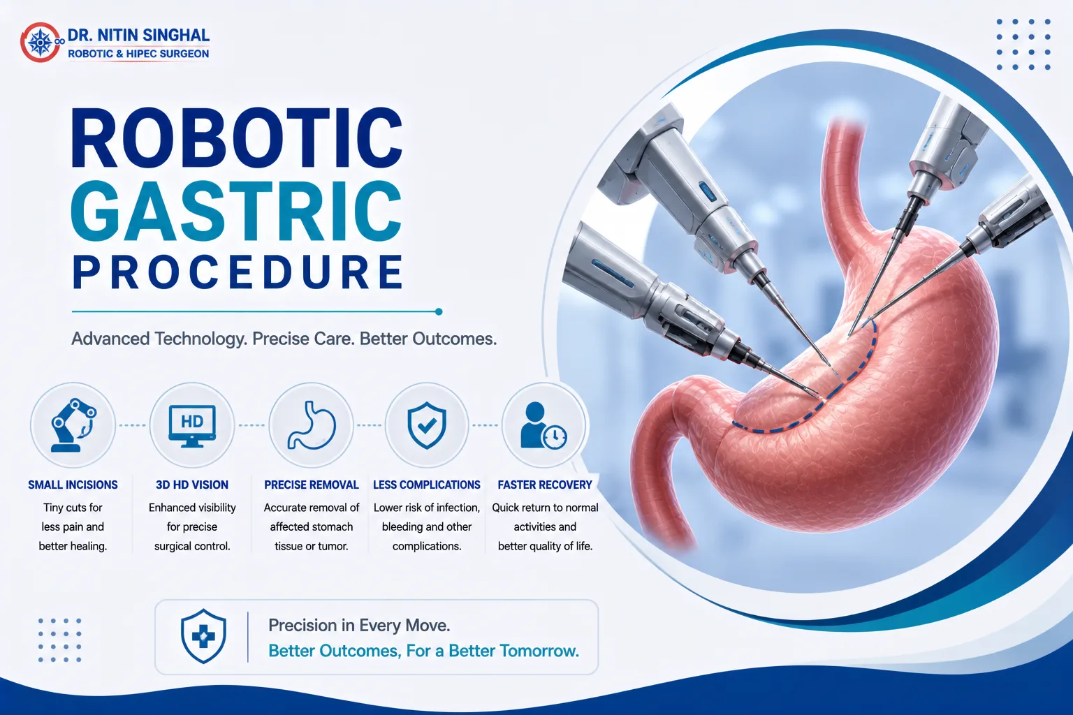 Types of robotic gastric procedures illustration