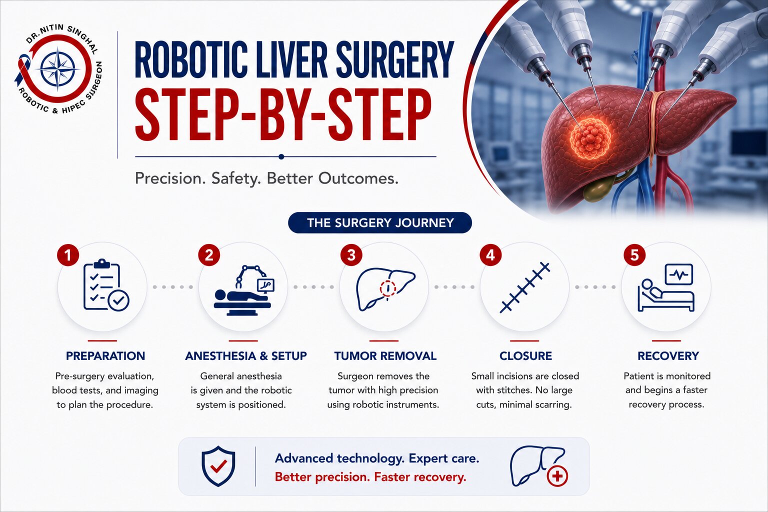 Robotic liver surgery step by step illustration