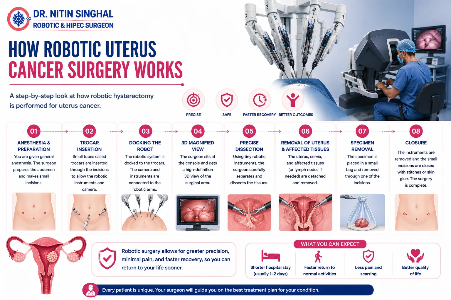 Robotic uterus surgery step by step illustration