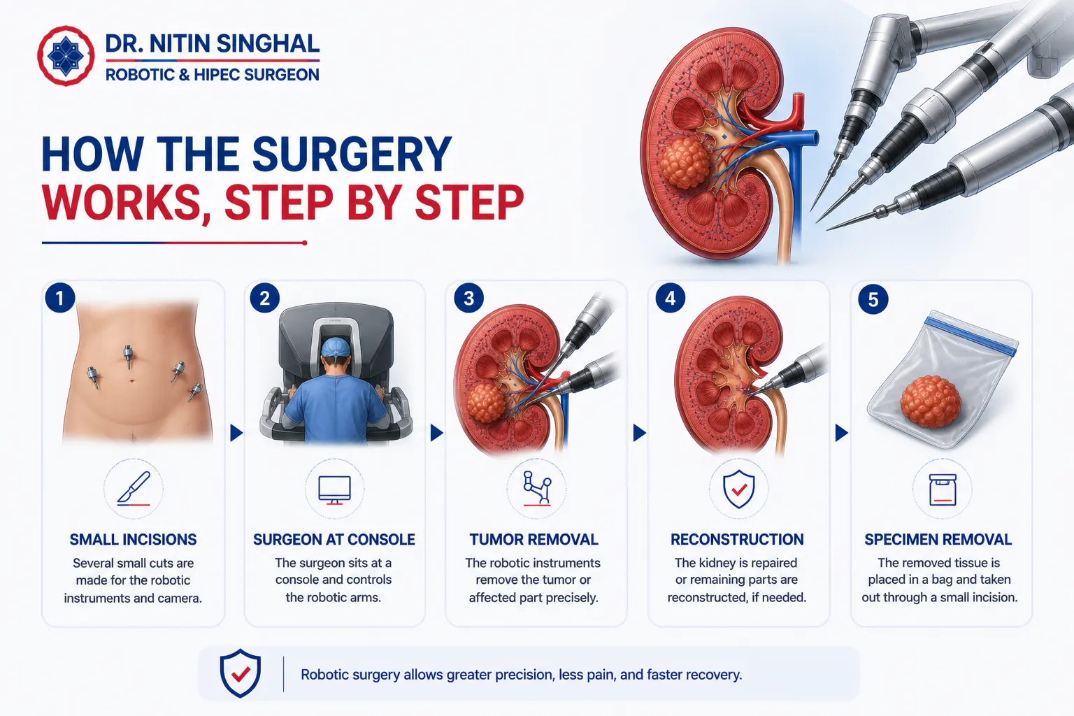 Robotic kidney surgery step by step illustration