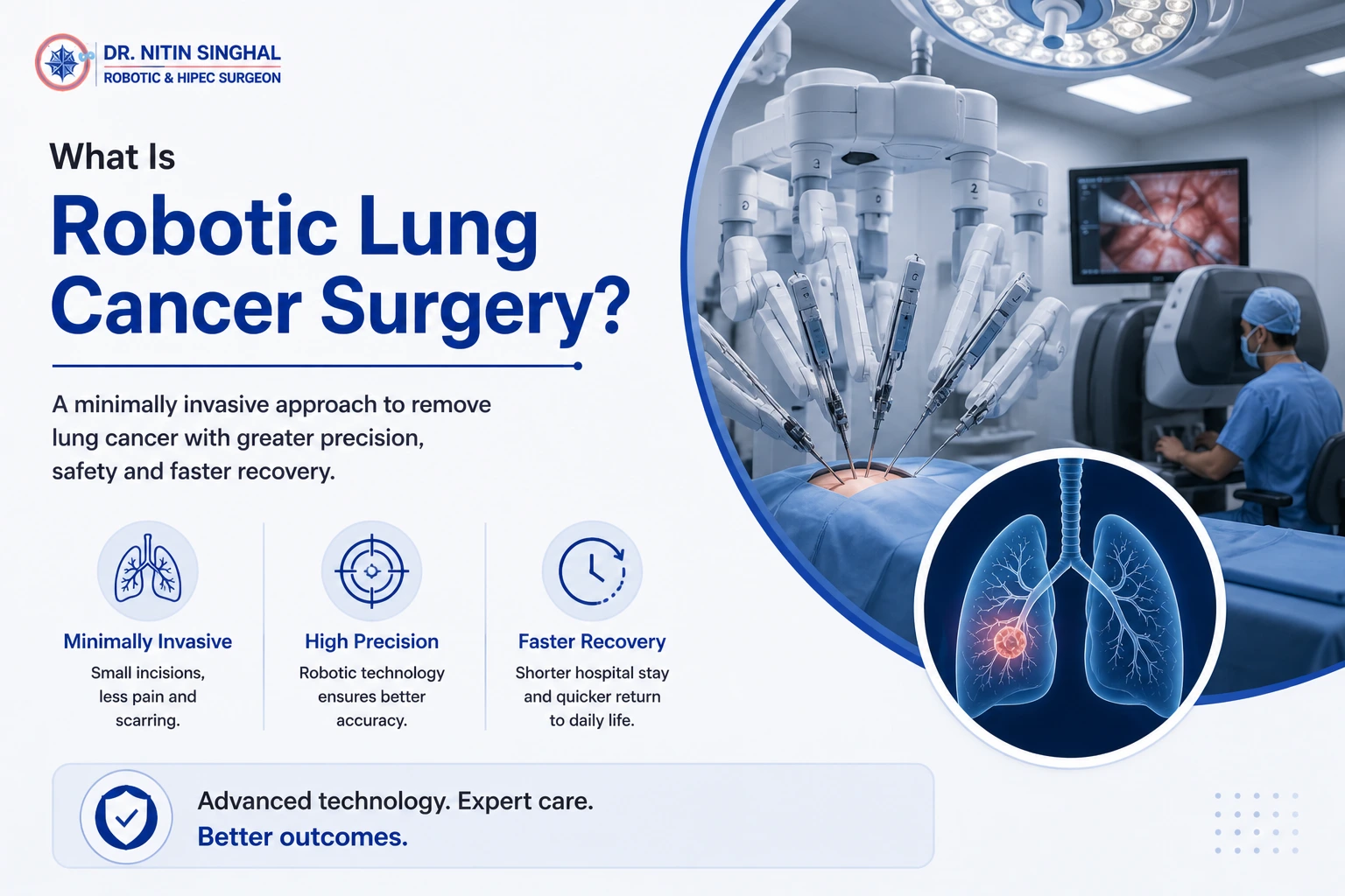 Robotic lung cancer surgery illustration, Dr. Nitin Singhal Ahmedabad