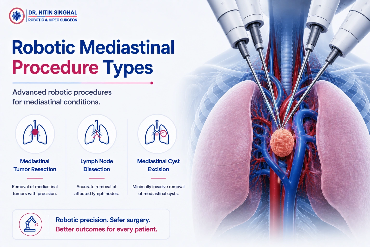 Types of robotic mediastinal procedures illustration