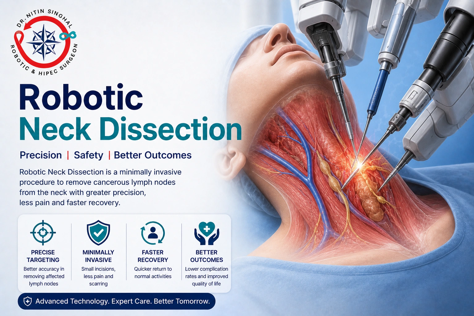 Robotic Neck Dissection, Dr Nitin Singhal Ahmedabad