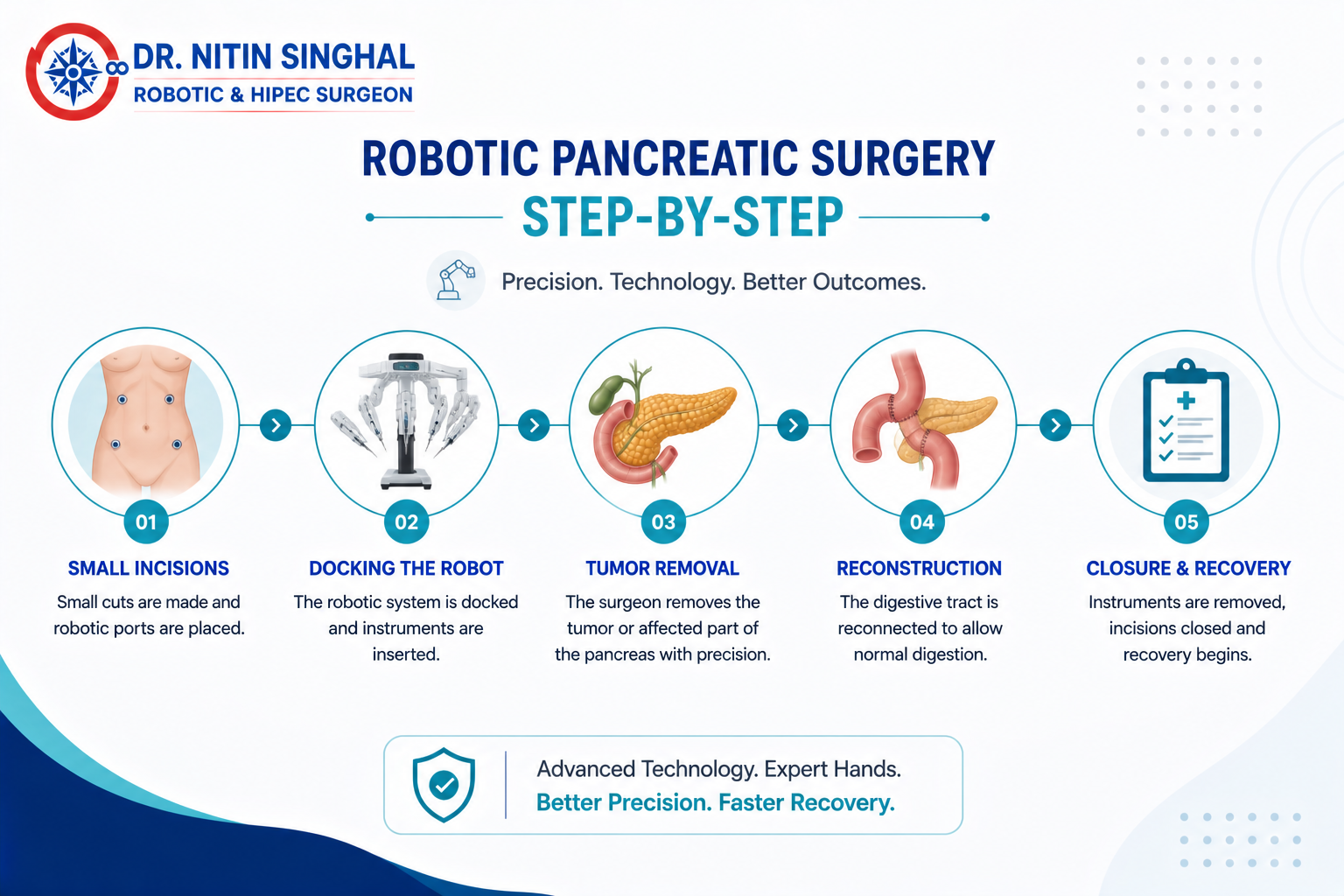 Robotic pancreatic surgery step by step illustration
