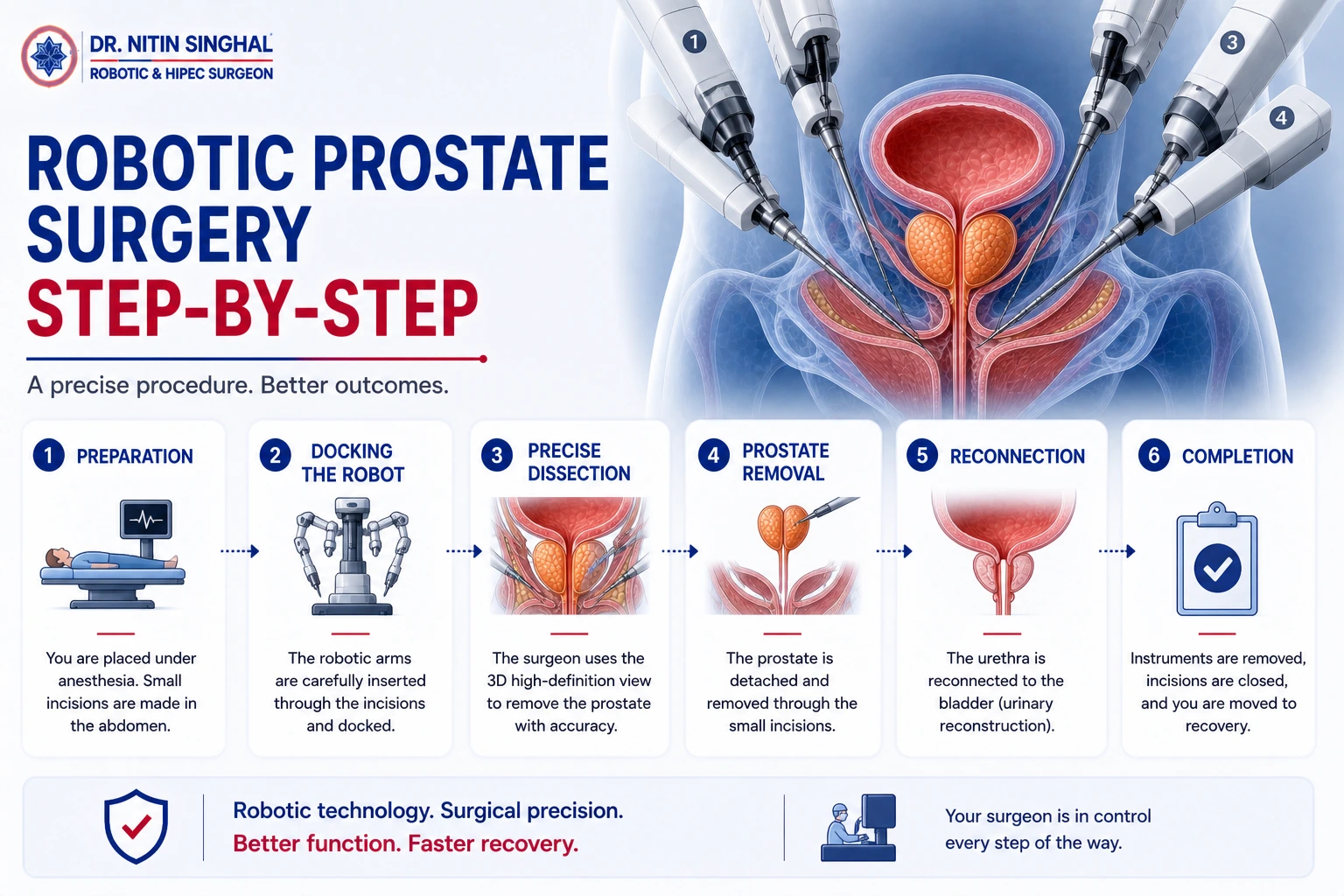 Robotic prostate surgery step by step illustration