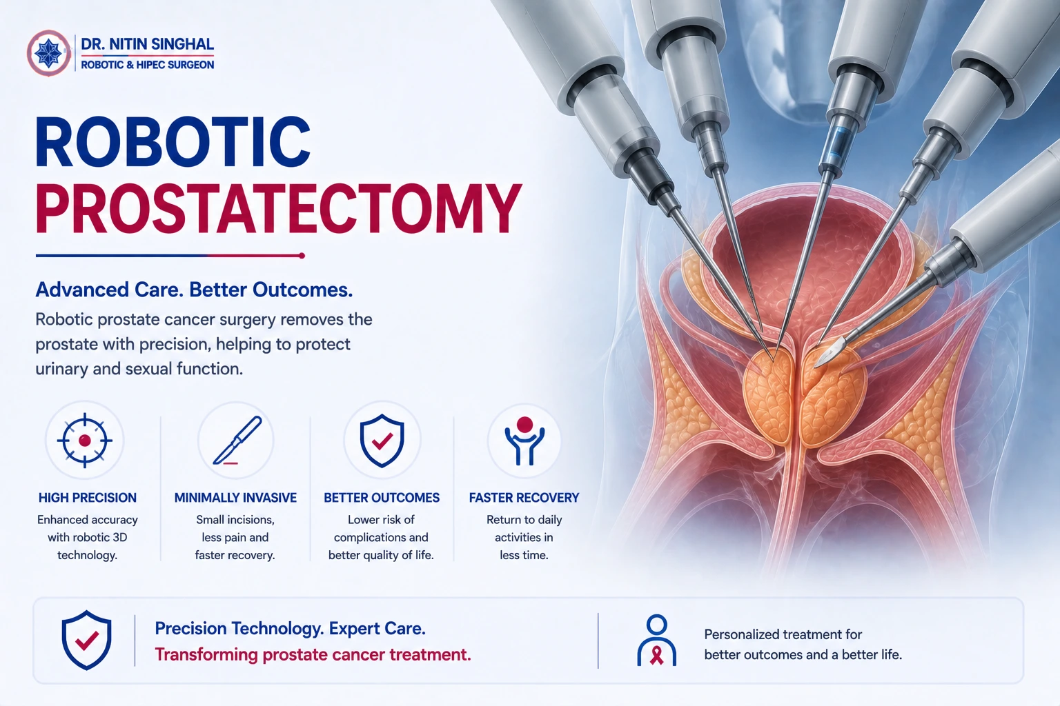 Robotic prostate cancer surgery illustration, Dr. Nitin Singhal Ahmedabad