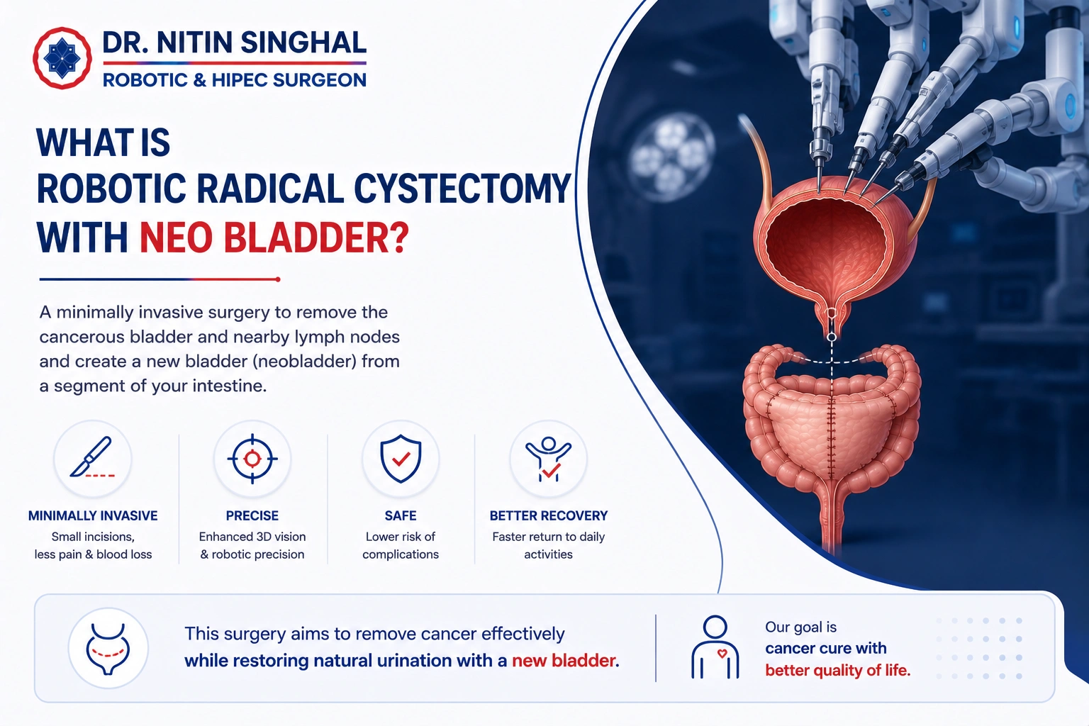 Robotic radical cystectomy procedure illustration
