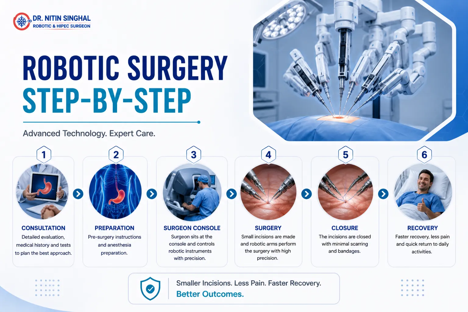 Robotic surgery step by step illustration