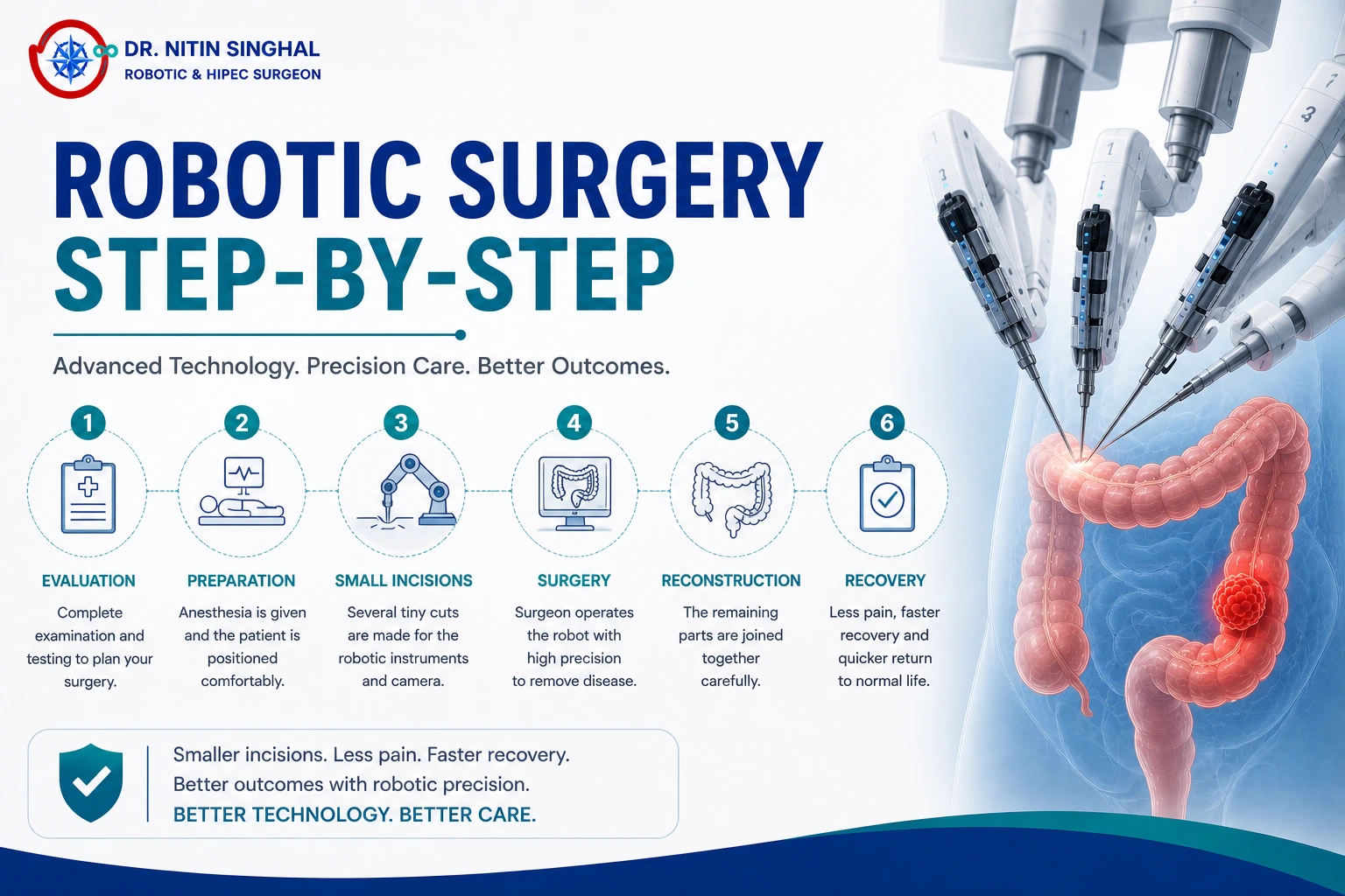 Robotic surgery step by step illustration