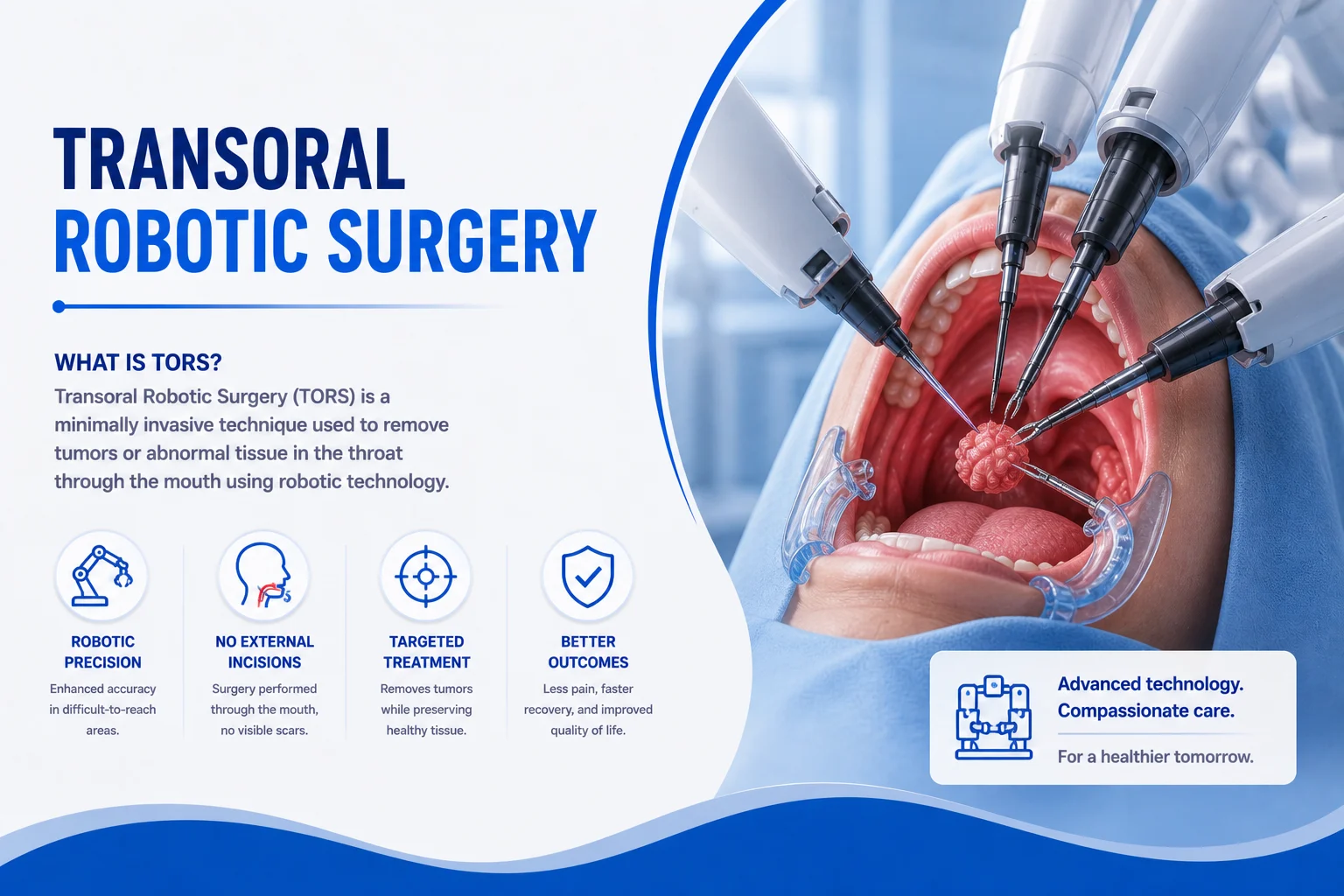 Transoral Robotic Surgery (TORS), Dr. Nitin Singhal, Ahmedabad