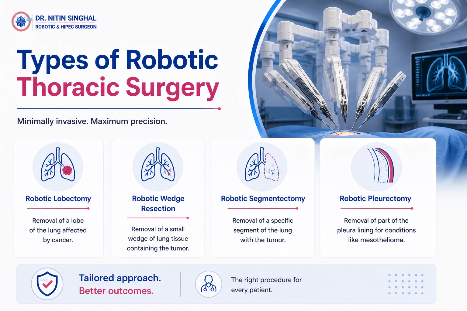 Types of robotic thoracic procedures illustration