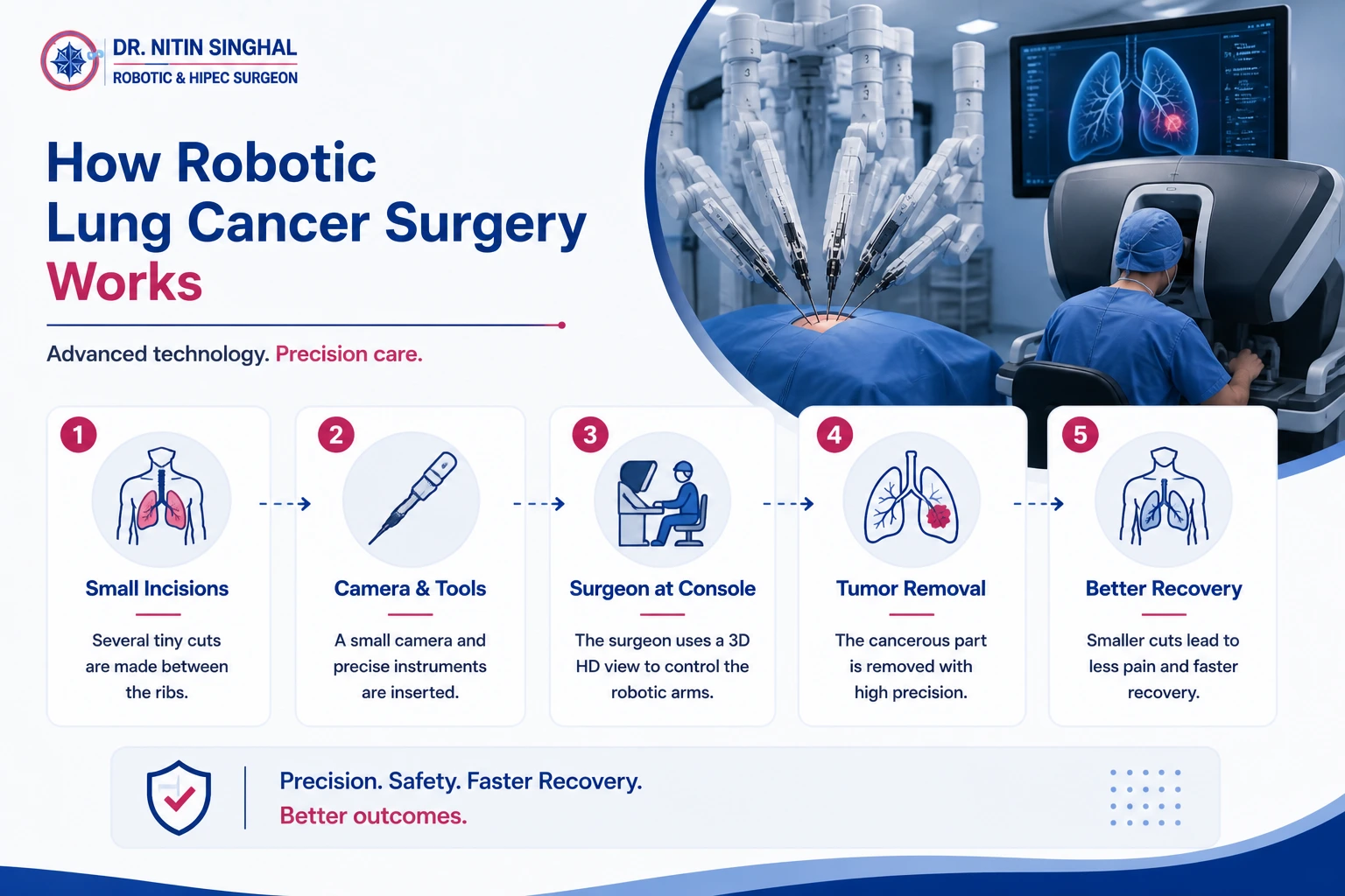 Robotic thoracic surgery step by step illustration