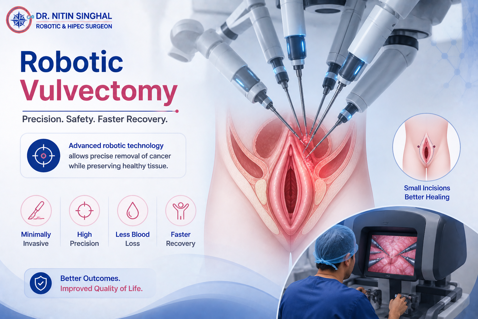 Robotic vulva cancer surgery illustration, Dr. Nitin Singhal Ahmedabad