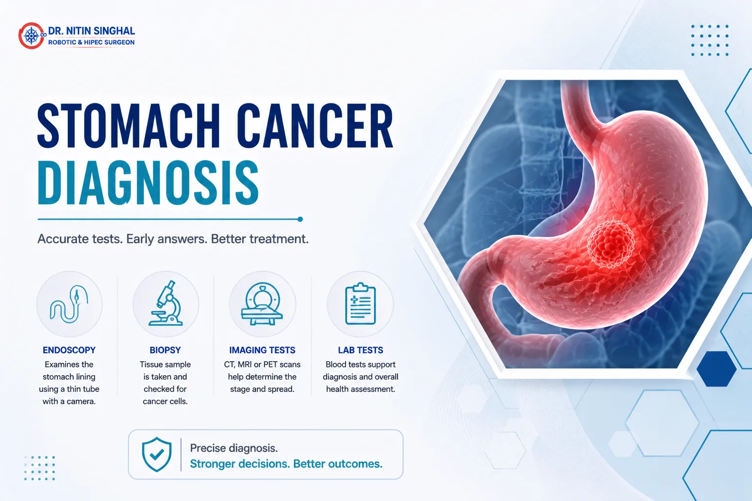 Stomach cancer diagnosis illustration