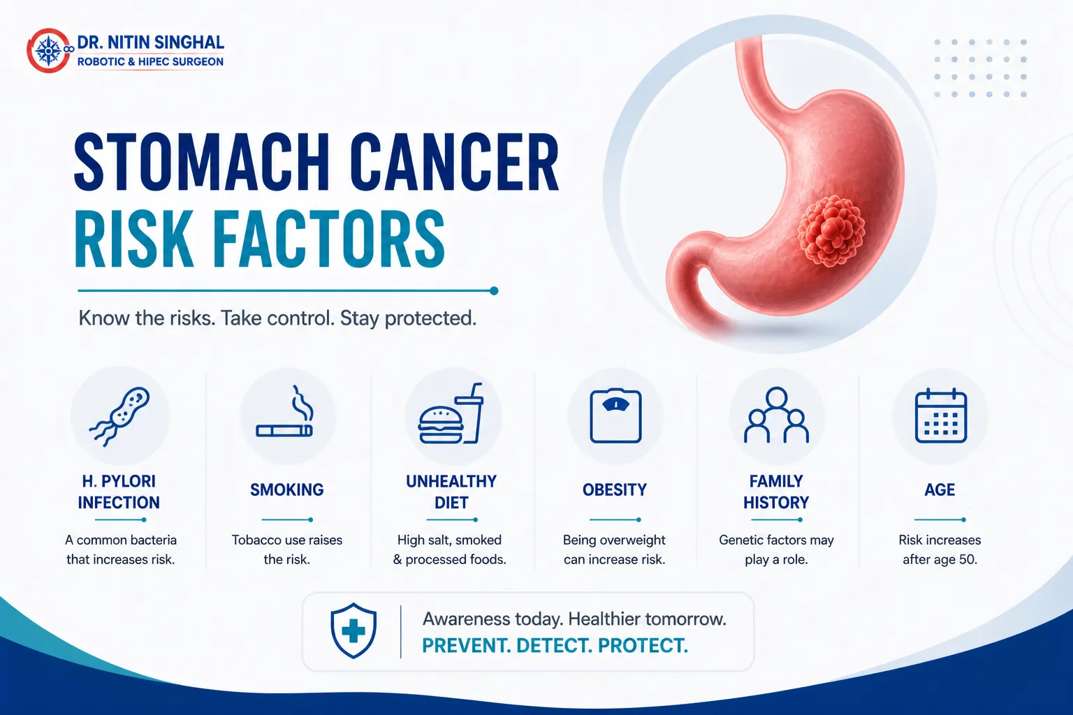 Stomach cancer risk factors illustration