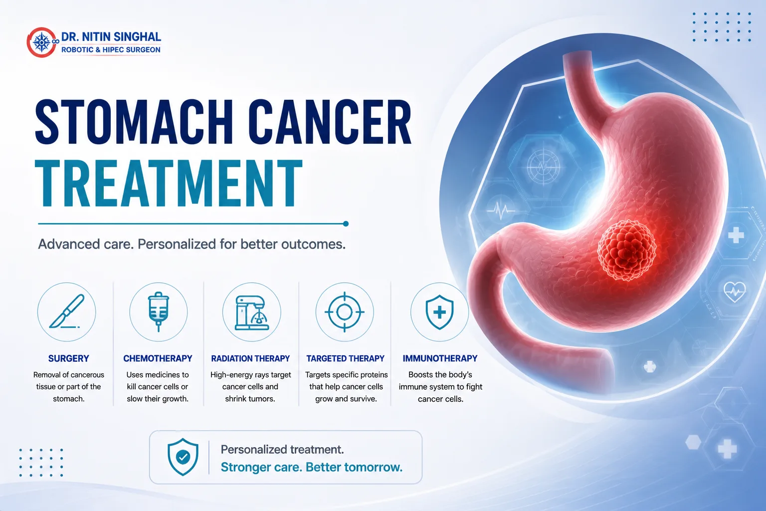 Stomach cancer treatment options illustration