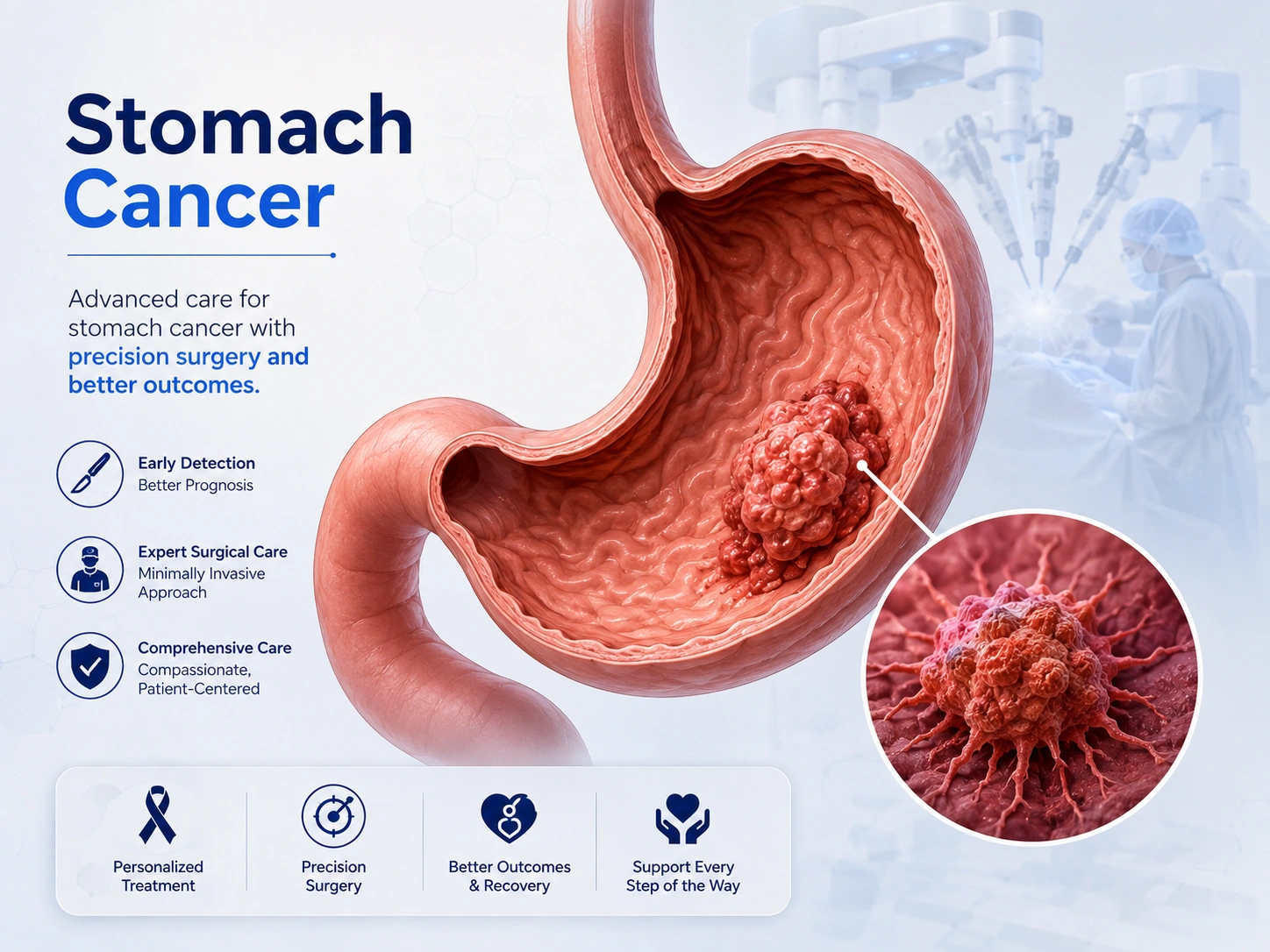 Stomach cancer illustration - tumour in the stomach, Dr. Nitin Singhal Robotic and HIPEC Surgeon