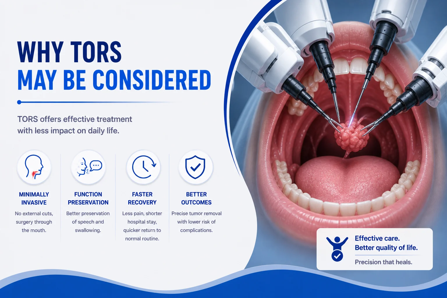 Benefits of transoral robotic surgery