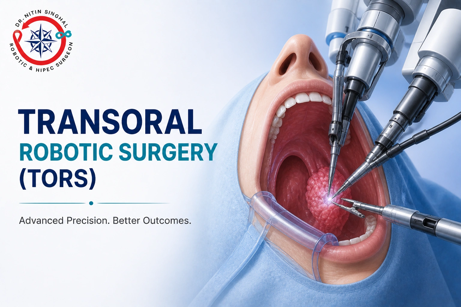Transoral Robotic Surgery (TORS), Dr Nitin Singhal Ahmedabad