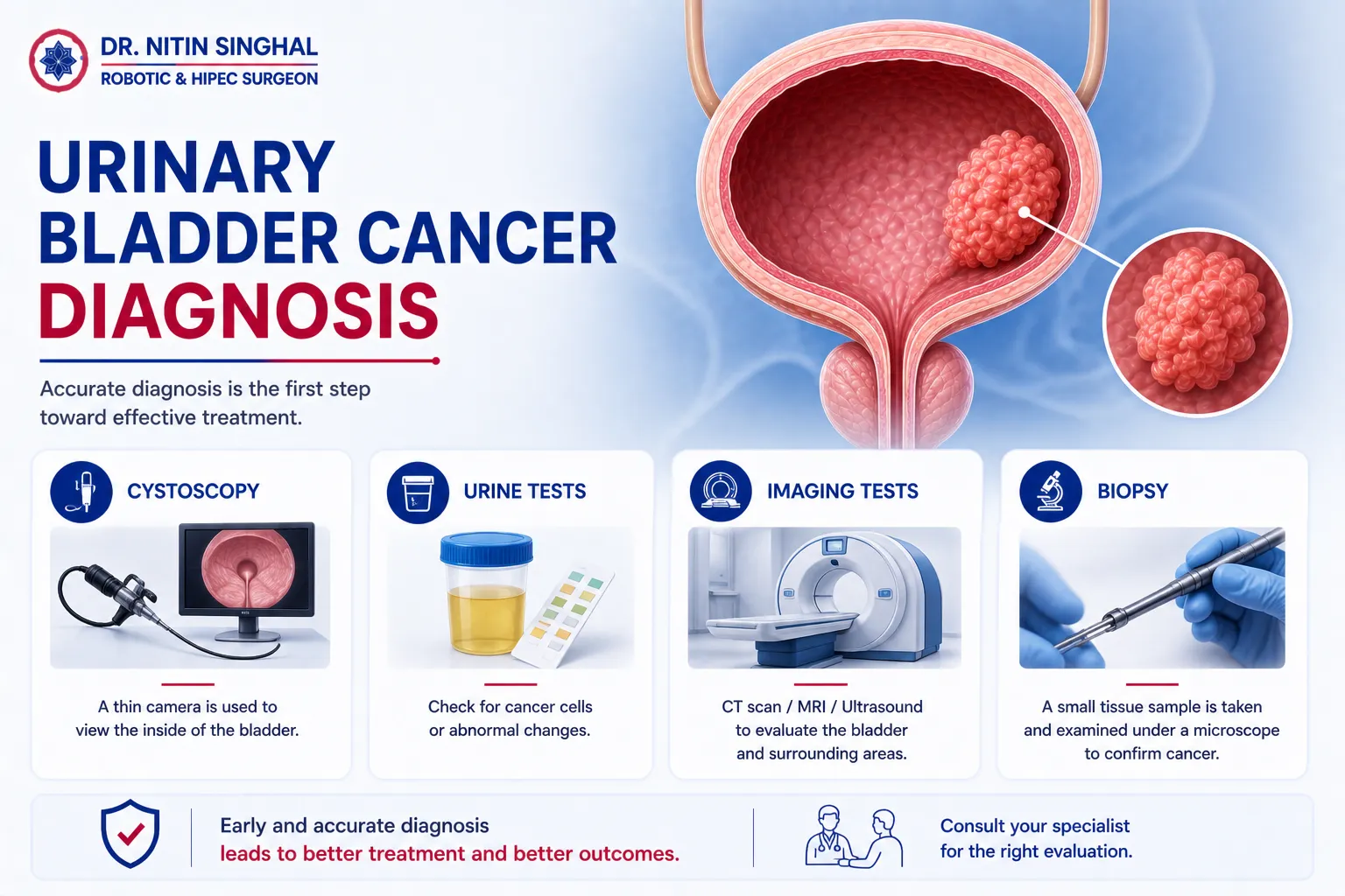 Urinary bladder cancer diagnosis illustration