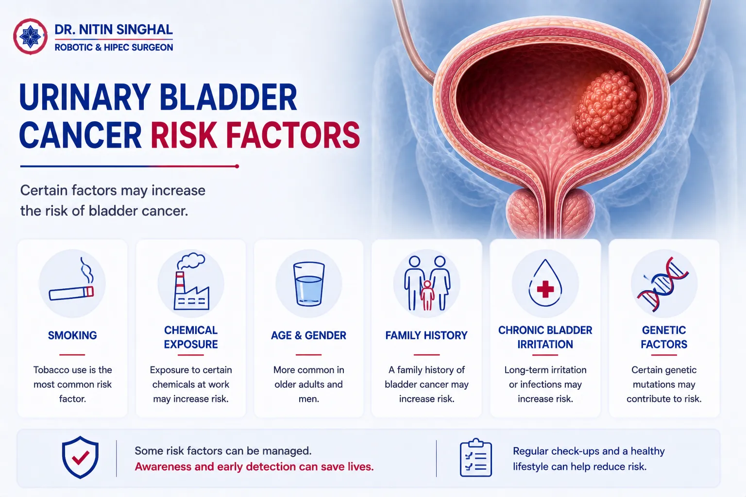 Urinary bladder cancer risk factors illustration