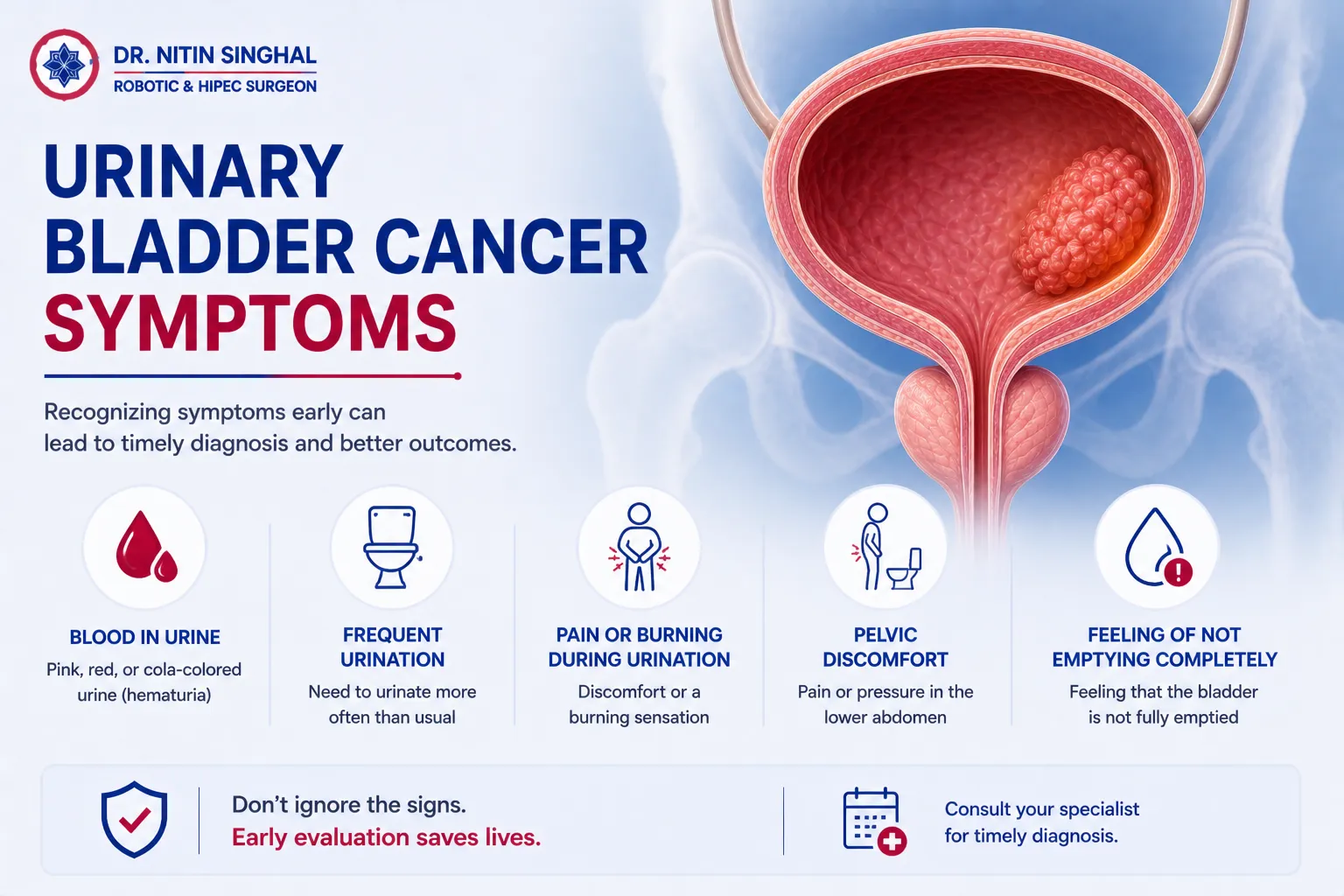Urinary bladder cancer symptoms illustration