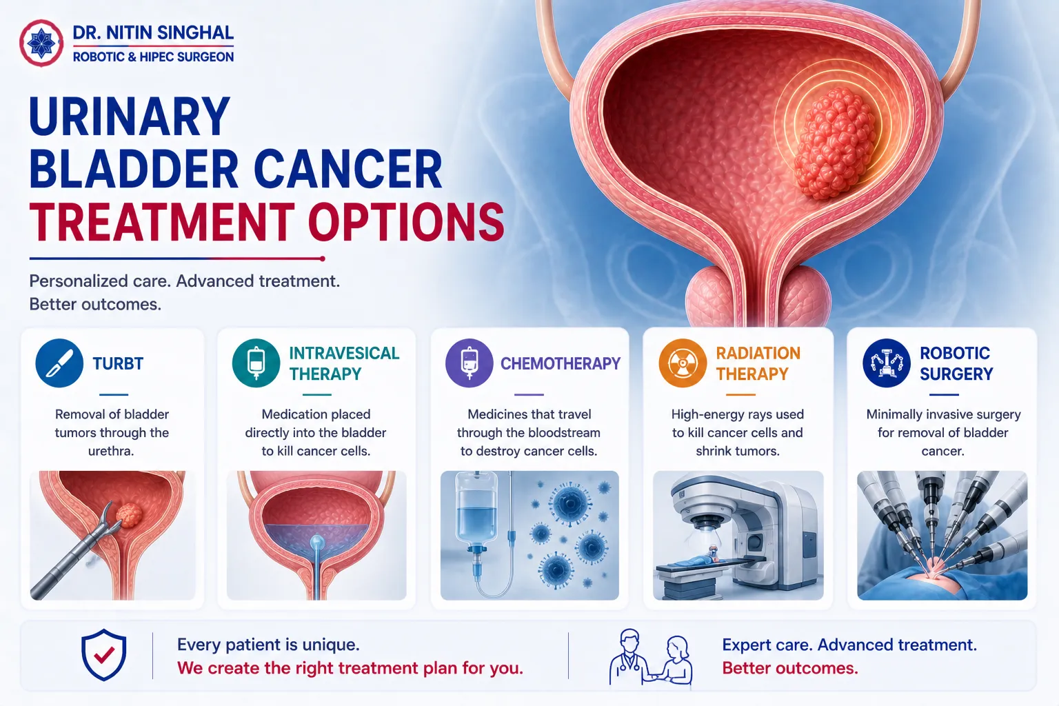 Urinary bladder cancer treatment options illustration
