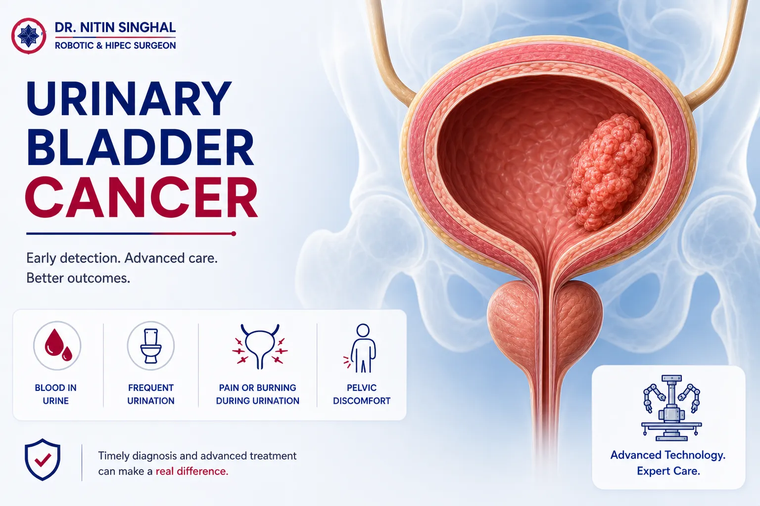 Urinary bladder cancer — robotic bladder cancer surgery, Dr. Nitin Singhal, Ahmedabad