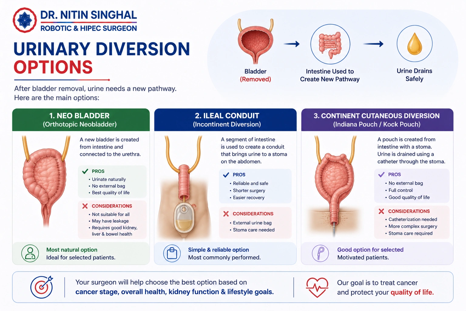 Ileal conduit urinary diversion