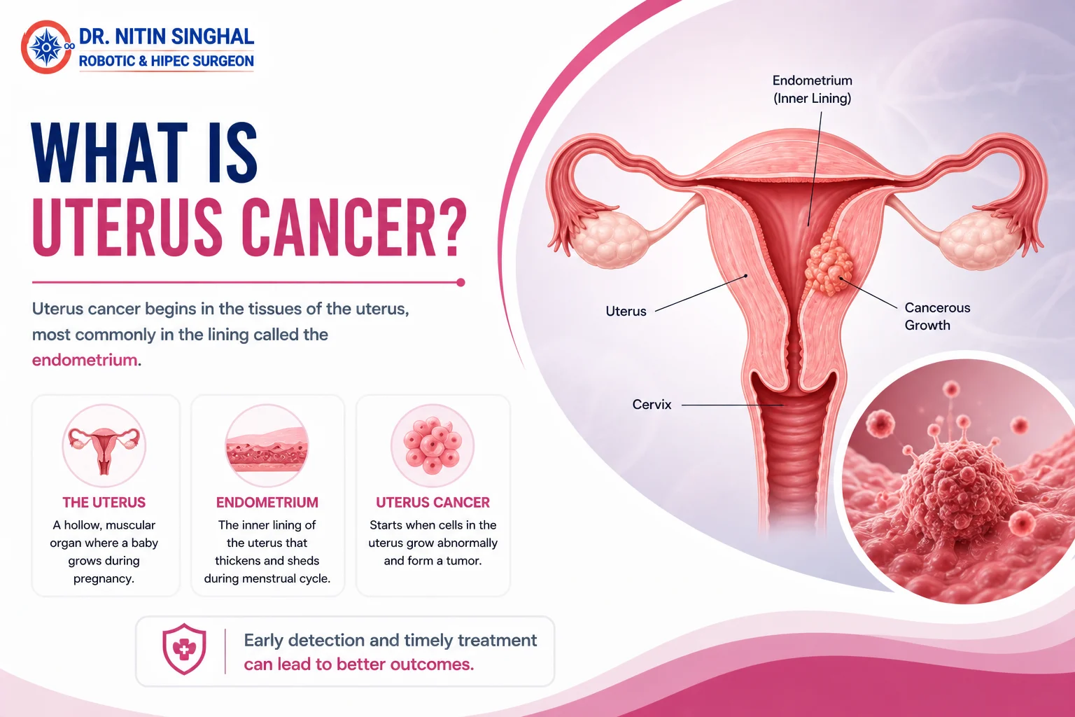 Uterus anatomy — robotic uterus cancer surgery, Dr. Nitin Singhal, Ahmedabad