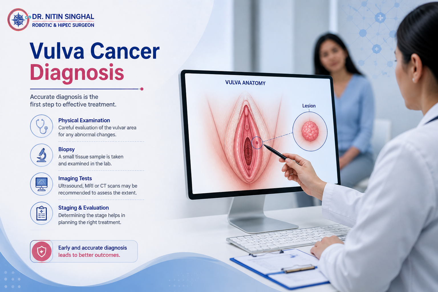 Vulvar cancer diagnosis illustration